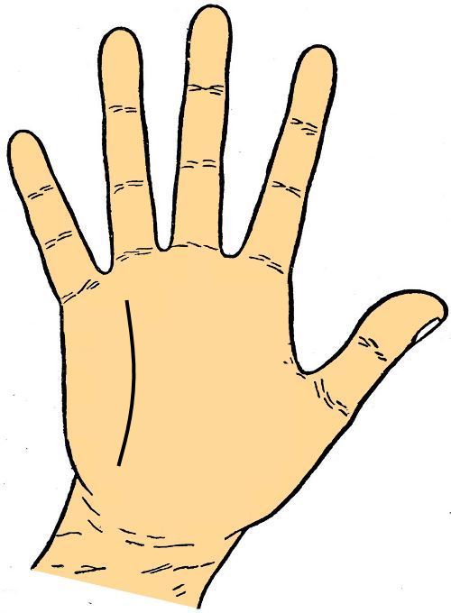 Sun Line in Palmistry
